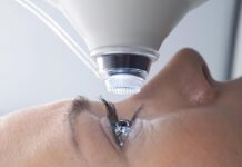 Лазерная коррекция зрения: что это такое, показания и противопоказания